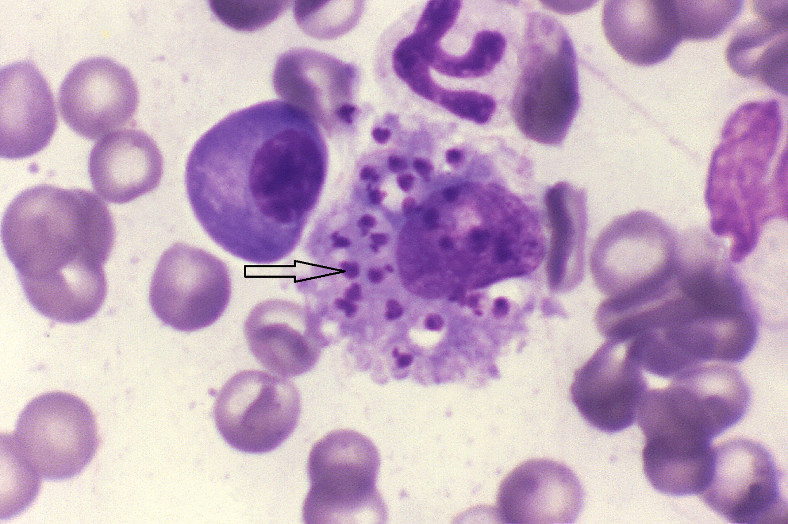 Leishmania_infantum_in_dog.png
